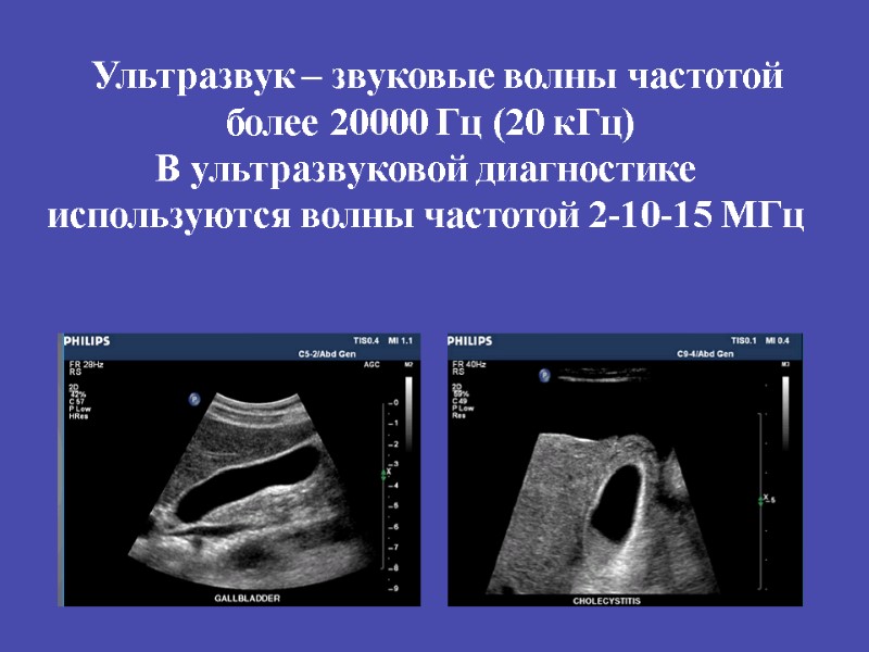 Ультразвук – звуковые волны частотой   более 20000 Гц (20 кГц) В ультразвуковой